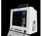 心電監護儀 EM9000P